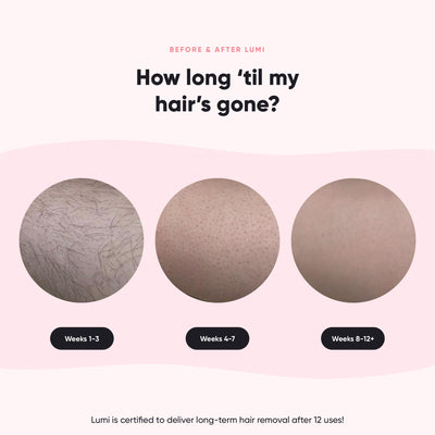 Silky Smooth+ Routine (Lumi 1 + 4D + 5 Gloves + Lotion)